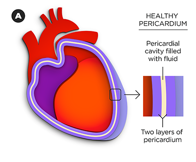 Healthy-Pericardium_labeled