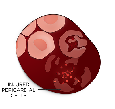 Injured-cells_labeled