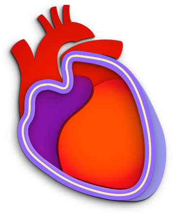 pericarditis