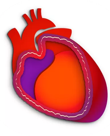 Definition of pericarditis image - swollen, inflamed pericardium