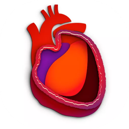 Constrictive pericarditis graphic